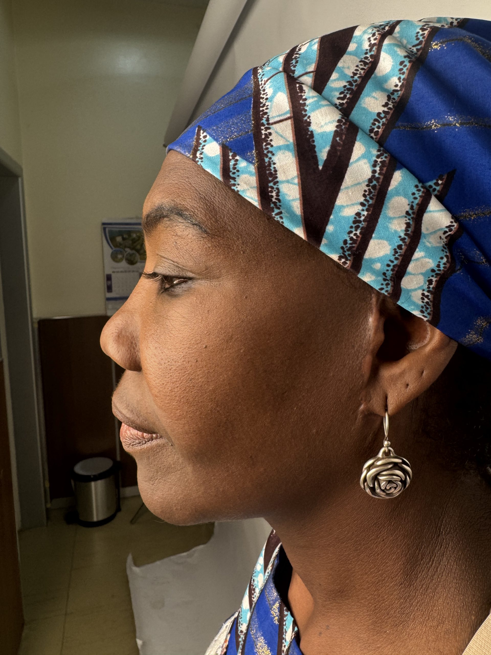 Eyelid Surgery (Blepharoplasty)